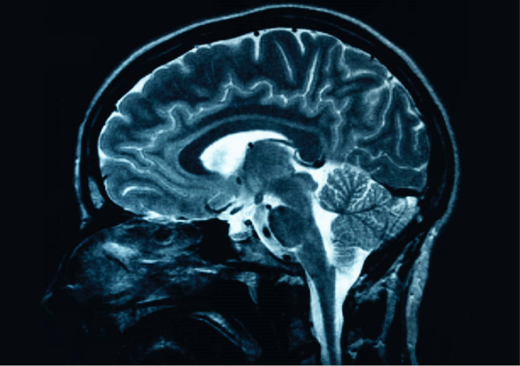 x ray of brain photo